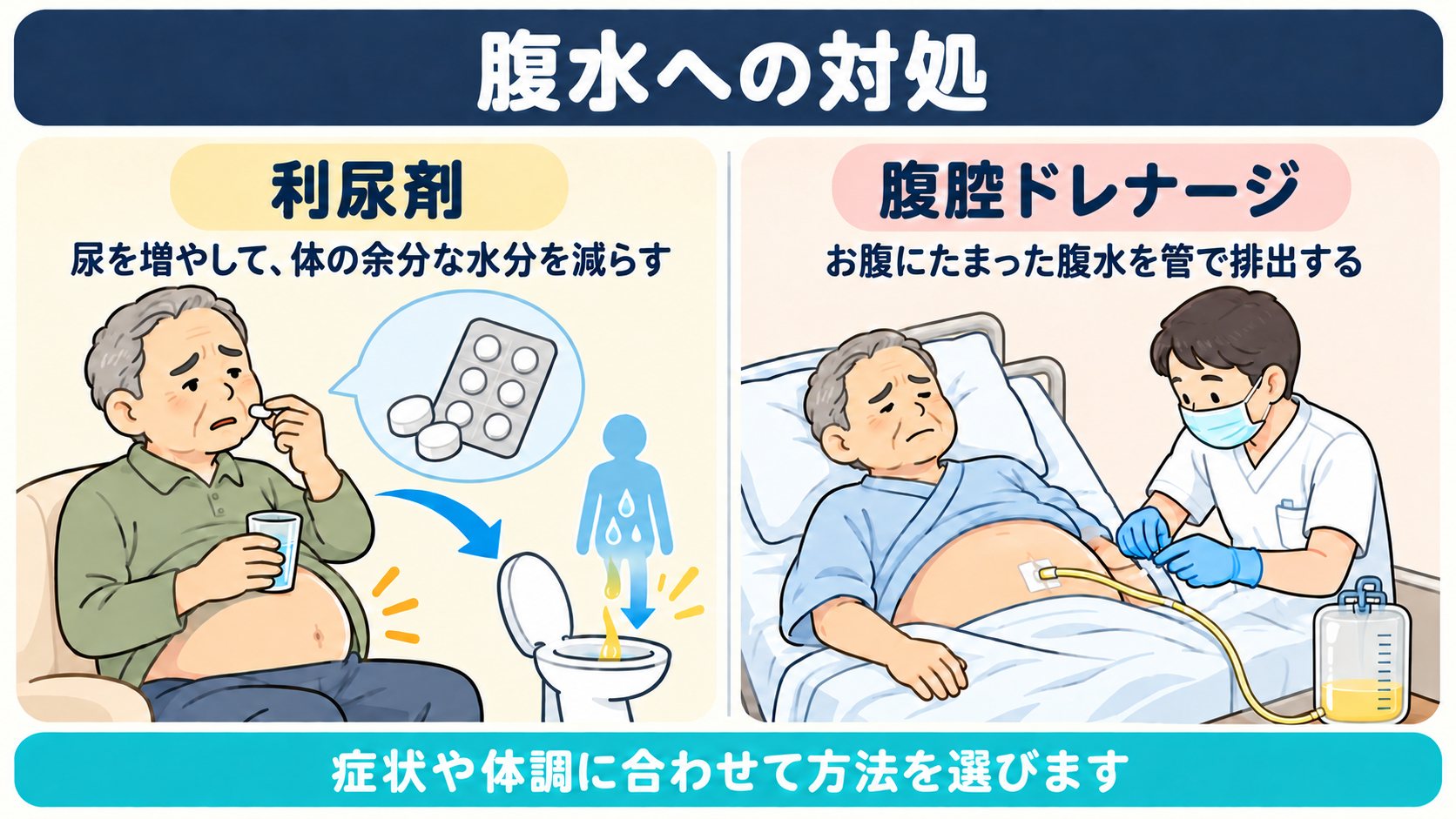 腹水への対処のイラスト